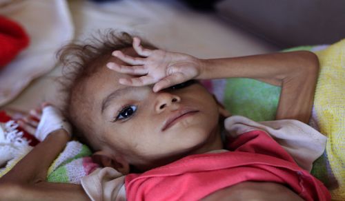 Hadi ni kama Al-Mashat, Wote Wametweza Majukumu Yao kwa Watu wa Yemen, na Wanapaswa Kung&#039;olewa